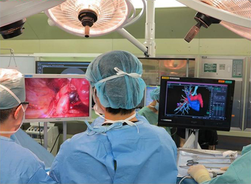 胸腔鏡を使用した手術の写真